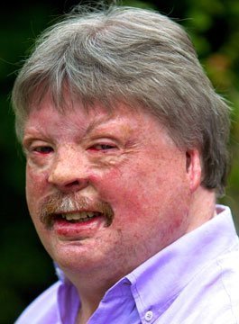 Simon Weston - Inspirational Military Speaker