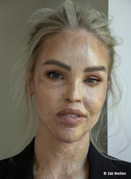 Katie Piper Inspirational Speaker